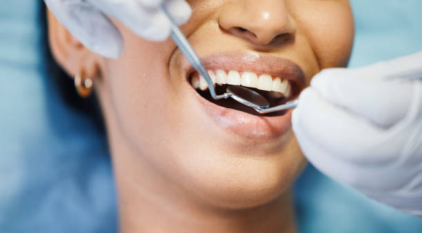 Best Emergency Tooth Extraction in Trezevant, TN